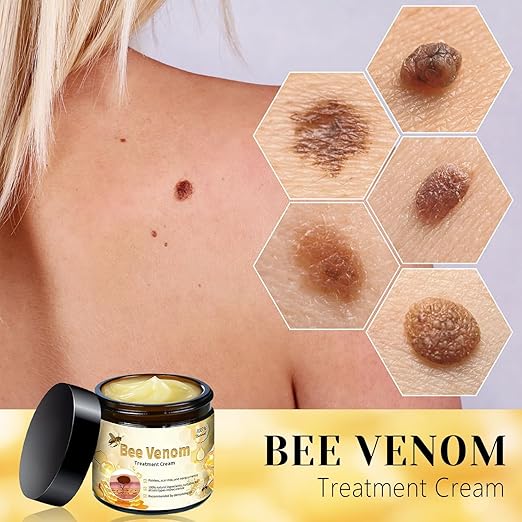 Bee Venom Skin Treatment Cream
