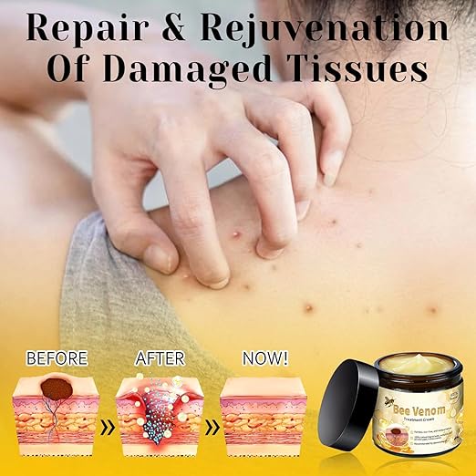 Bee Venom Skin Treatment Cream