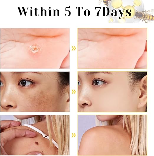Bee Venom Skin Treatment Cream